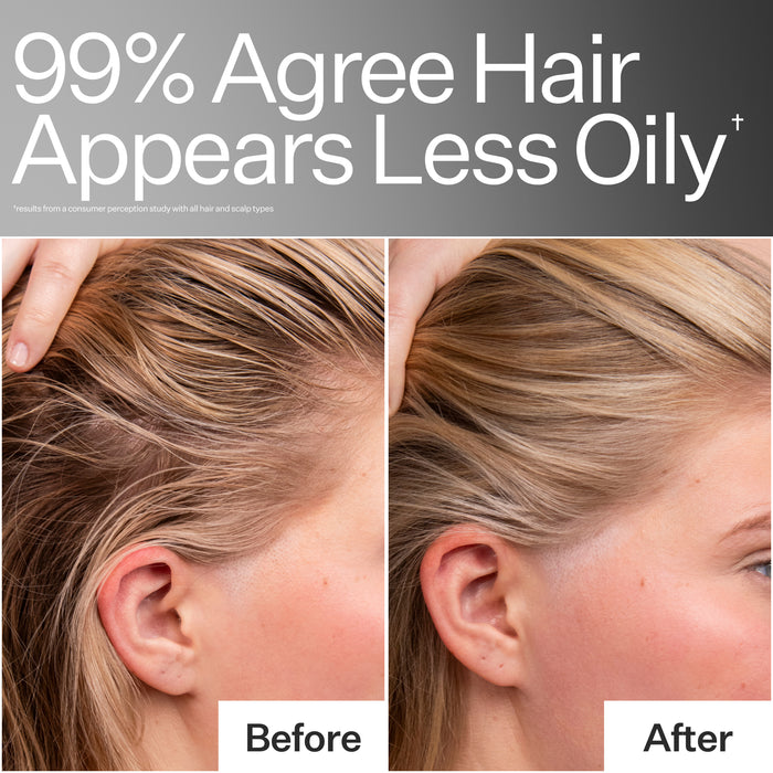 Act+Acre 4% Niacinamide Oily Scalp Serum