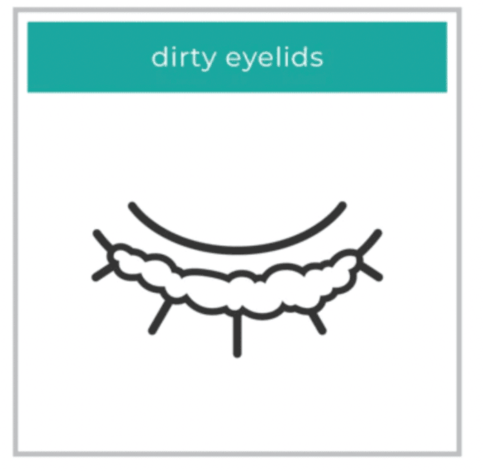 WE LOVE EYES Eyelid Margin Cleansing Brush