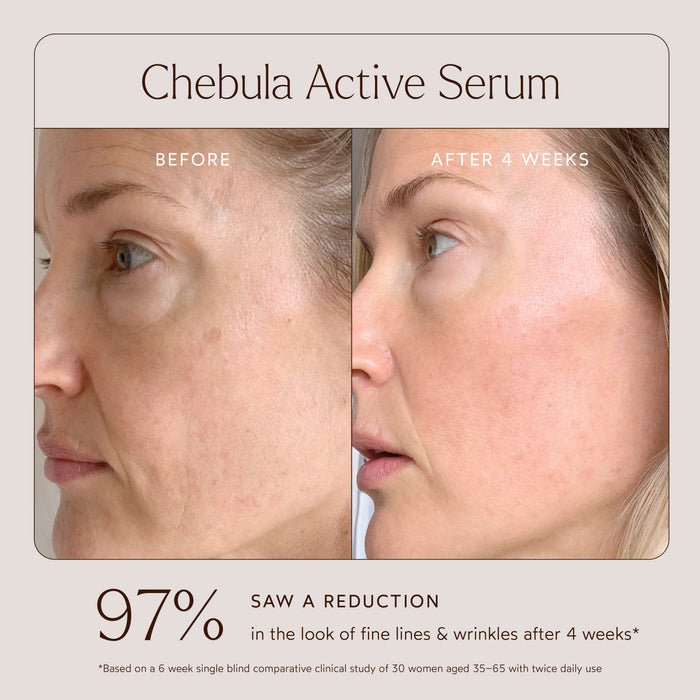 True Botanicals-3 Steps to Glowing Skin-Set-RetailResizeBefore_Afters1-05-The Detox Market |