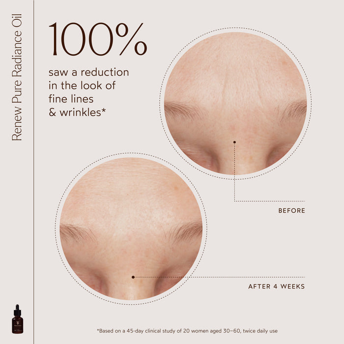 True Botanicals-3 Steps to Glowing Skin-Set-RetailResizeBefore_Afters3-17-The Detox Market |