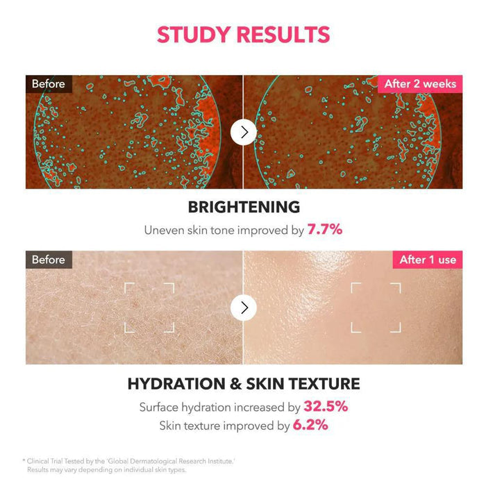 APRILSKIN TXA + Niacinamide 99 Pink Milky Toner 150 mL