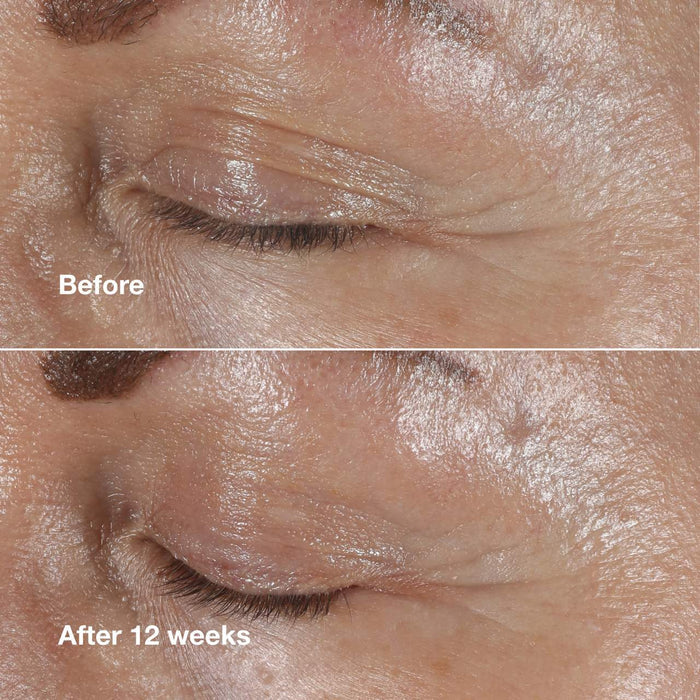 Clinique Smart Clinical Repair Wrinkle Correcting Eye Cream in 15ml jar, showing the unopened beauty product with branding and packaging.