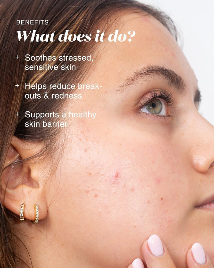 Close-up of a woman's face and ear with text on the left reading 'BENEFITS What does it do?' and bullet points about soothing stressed/sensitive skin, reducing breakouts and redness, and supporting a healthy skin barrier.