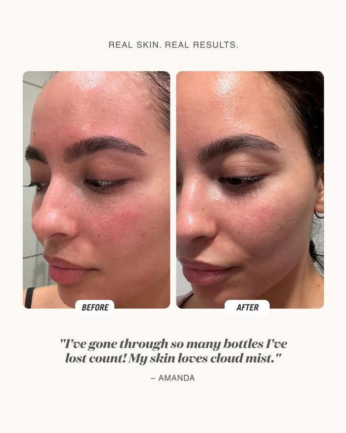 Before and after skincare comparison showing a woman's face, with text reading 'REAL SKIN. REAL RESULTS.