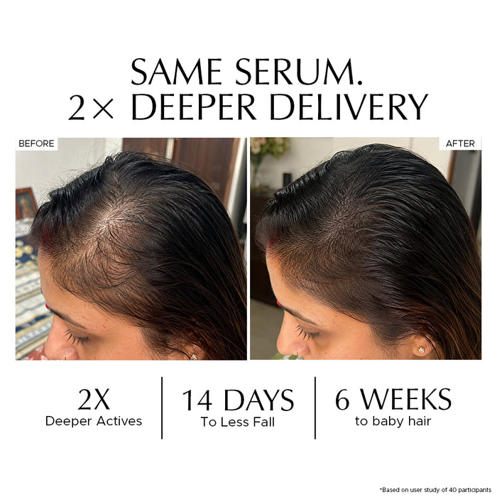 Combo: Encapsulated Cica Reedle Essence + Hair Vitalizer 2.0