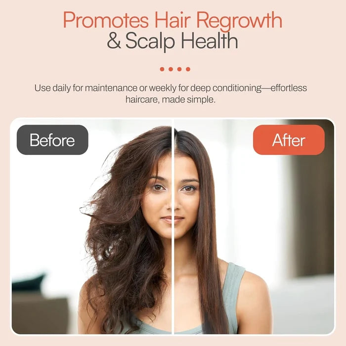 Foltene Pharma Conditioner Hair Beautifier - Promotes Hair Regrowth