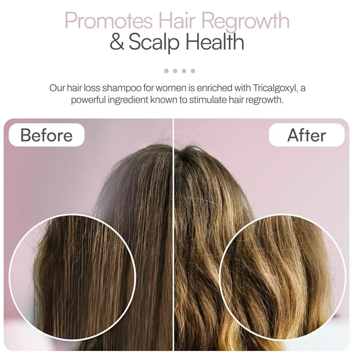 Foltene Pharma Strengthening for Thinning Hair Women Shampoo - Before After