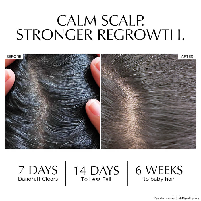 Hair Growth Combo - Anti Dandruff Scalp Tonic + Hair Vitalizer 2.0