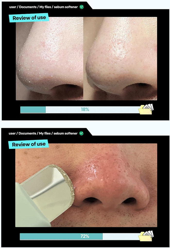 ILSO Super Melting Sebum Softener 150 g