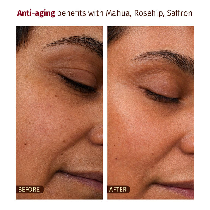 Befor and After Result -Mahua Miracle Oil