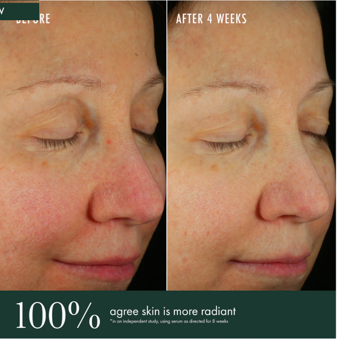 ReVive Brightening Serum in 30ml bottle, featuring a sleek design and dropper applicator, for radiant skin enhancement.