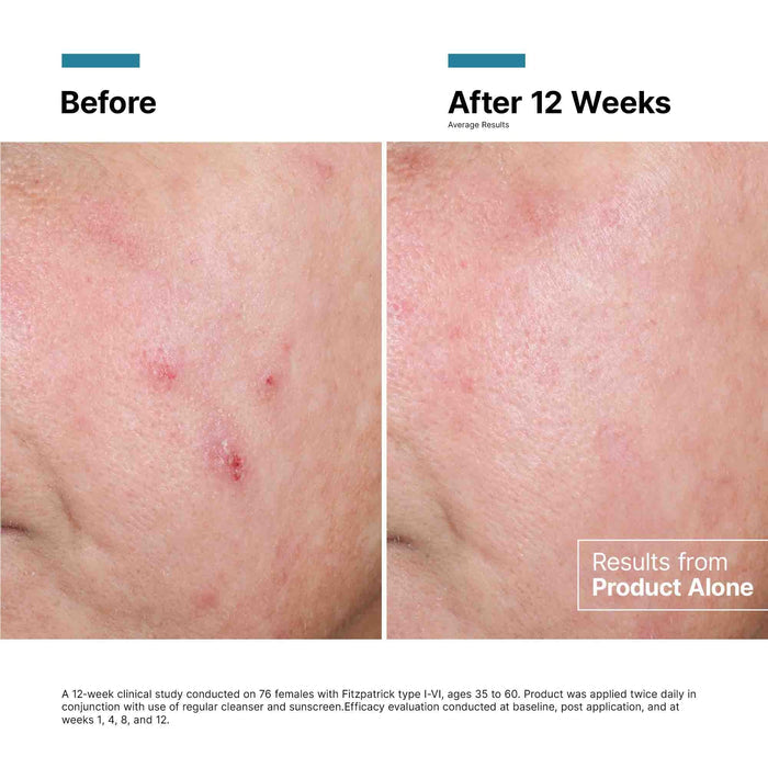 SkinCeuticals - Advanced RGN-6
