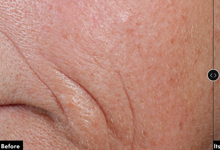 SkinCeuticals C E Ferulic with 15% l-ascorbic acid