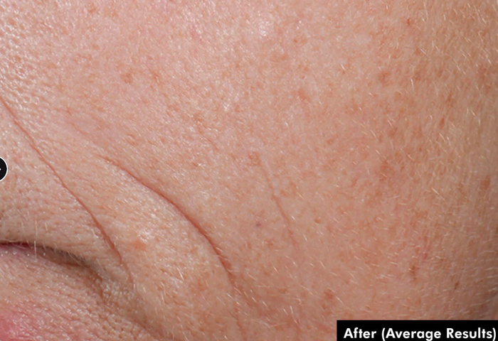SkinCeuticals C E Ferulic with 15% l-ascorbic acid