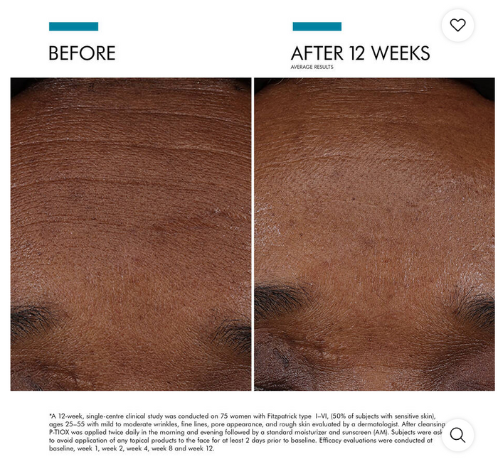 SkinCeuticals P-TIOX