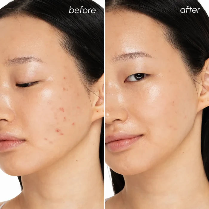 Witch Hazel Clearing Pads